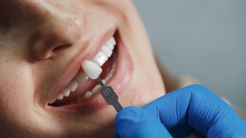 4 Signs You Need to Go for Dental Implants
