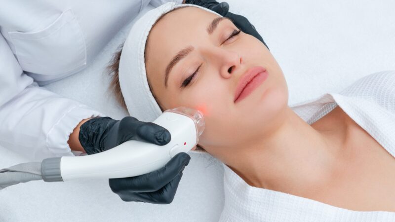 How Laser Treatments Can Improve Skin Tone and Texture